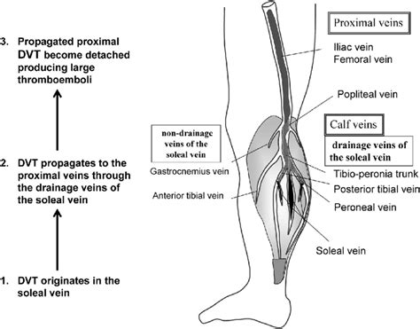Suspected Mechanism Of Venous Thromboembolism Resulting In Lethal