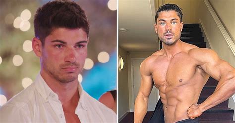 A Look At The Huge Transformation Anton Has Had Since Love Island