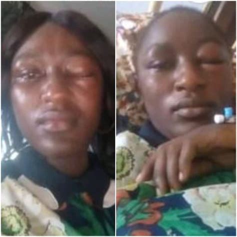 Nigerian Woman Battered By Husband Cries Out
