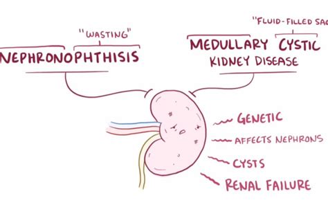 【搬运osmosis】nephronophthisismedullary Cystic Kidney Disease哔哩哔哩bilibili