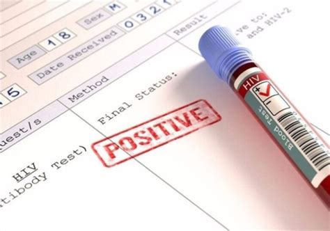 All You Need To Know About Hiv Testing Demotix