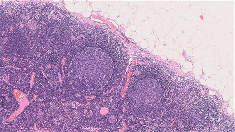 Lymph Node Normal Histology Nus Pathweb Nus Pathweb