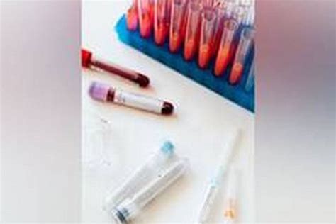 Blood Test Can Predict Metastasis Risk In Melanoma Study