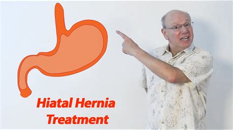 Hiatal Hernia Treatment Without Surgery Youtube