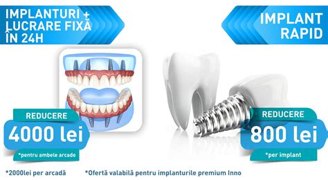 Cum Sa Te Bucuri De O Proteza Fixa Cu 4 Implanturi Pret De O Viata