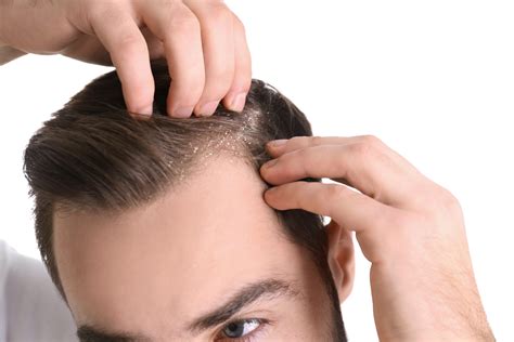 5 Reasons Why Your Scalp Is Itchy And How To Fix It