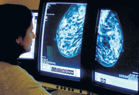 Ai Breast Screening Hopes For Cancer Care
