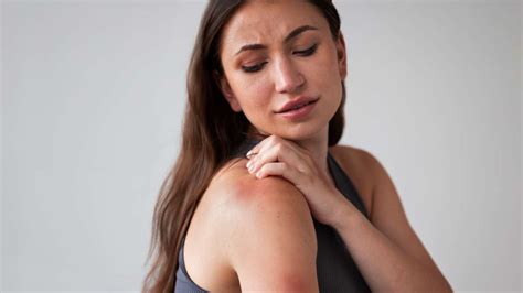 Skin Rashes 5 Types Causes And Effective Treatments India Tv
