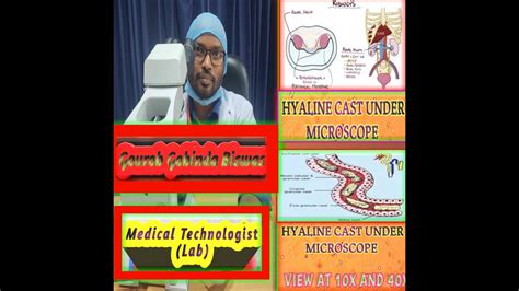 Casts In Urine Hyaline Casts In Urine Hyaline Tests In Bangla YouTube