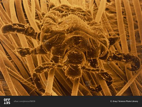 Color Scanning Electron Micrograph Of Pubic Louse Phthirus Pubis