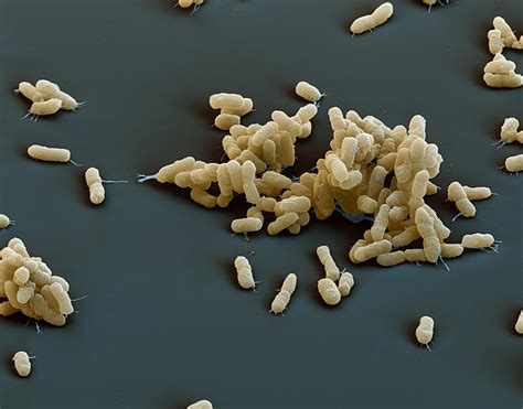 Plague Bacteria Yersinia Pestis Sem Photograph By Meckesottawa