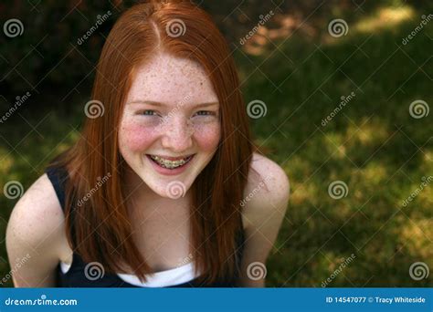 Redhead Freckles Braces Pale Skin