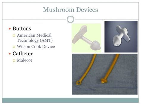Ppt Nursing Considerations For Enteral Tubes Powerpoint Presentation