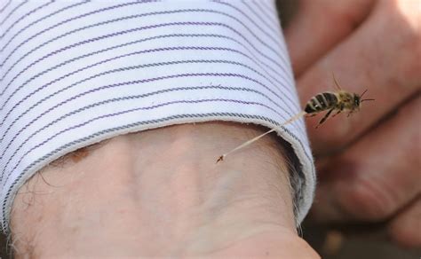 Rare Photo Captures The Exact Moment A Bee Leaves Its Stinger In A Man S Arm Daily Mail Online