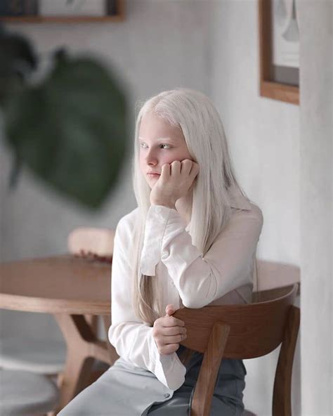 Stunning Portraits Of 11 Year Old Girl With Albinism And Heterochromia