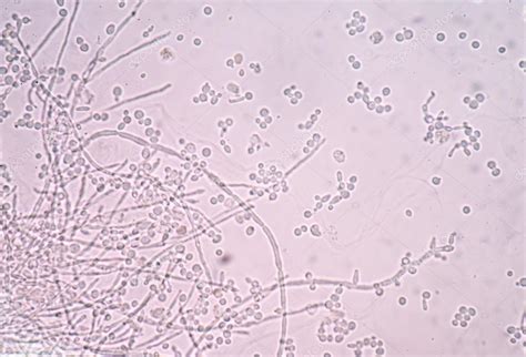 Budding Yeast Under Microscope