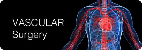 What Is A Vascular Surgery Life Health Max