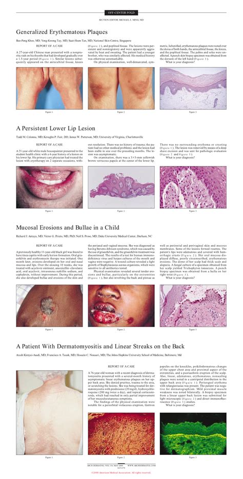 A Persistent Lower Lip Lesion Dermatology Jama Dermatology Jama