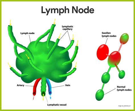 Lymph Nodes The Lymph Nodes In Particular Help Protect The Body By