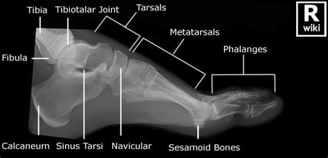 In particular, these techniques show the bones structures, ligaments, muscles and tendons, taking part to the arch setting. Foot Radiographic Anatomy | Radiology student, Medical ...