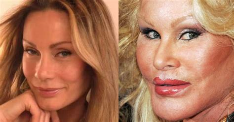 darin nelson extreme plastic surgery srz php