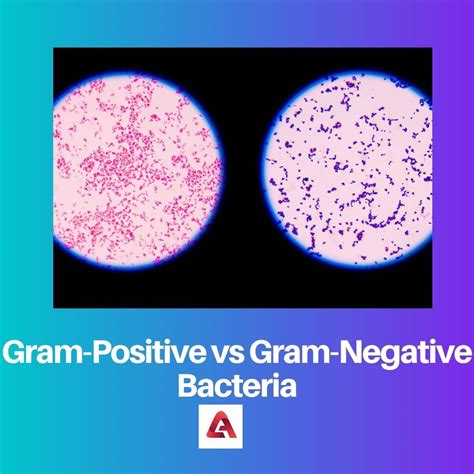 Gram Positive Vs Gram Negative Bacteria Difference And Comparison