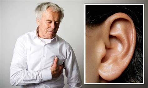 Heart Attack Warning Sign On The Ear That Could Predict The Condition