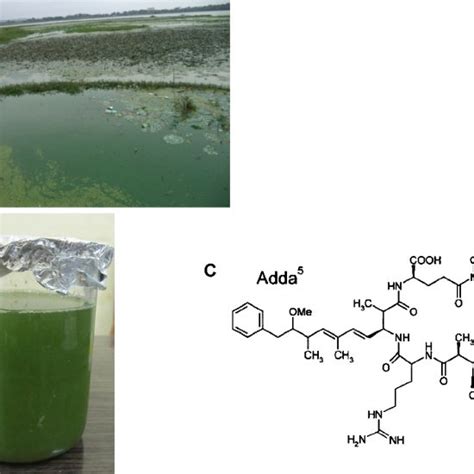 Microcystis Aeruginosa Bloom In Sagar Lake Water A Sample Of Water