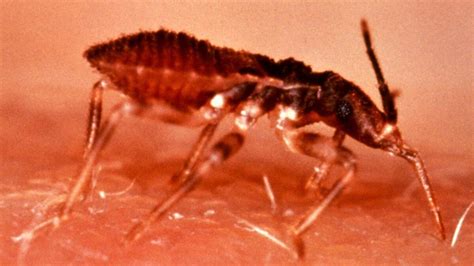 Kissing Bug Disease More Deadly Than Thought