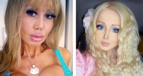 Dear Barbie Obsessed Woman Getting Hypnotherapy To Be Brainless Its