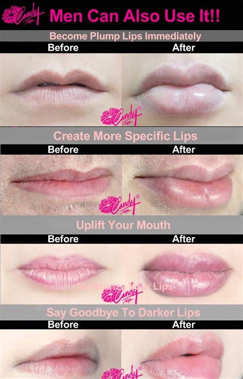 How To Plump Lips With 11 Non Invasive Methods Diy Lip Plumper Lip
