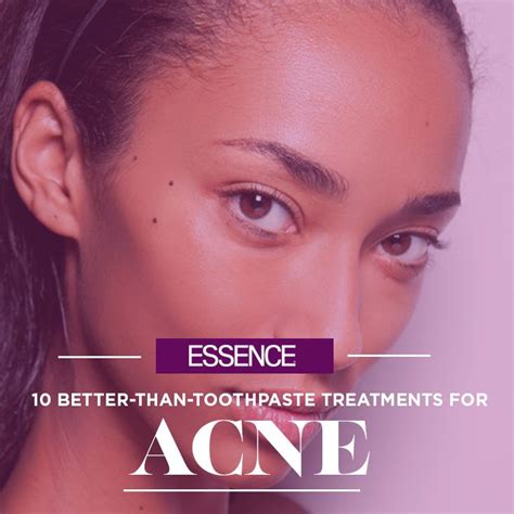 10 Overnight Acne Treatments That Are Better Than Toothpaste Clear