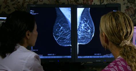 Morning Rounds 3d Mammograms Enhance Cancer Screening Cbs News