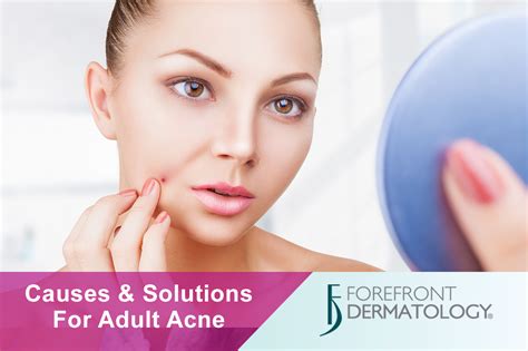 Causes And Solutions For Adult Acne Forefront Dermatology
