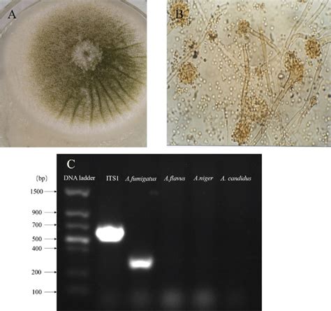 Isolation And Identification Of Aspergillus Fumigatus A The