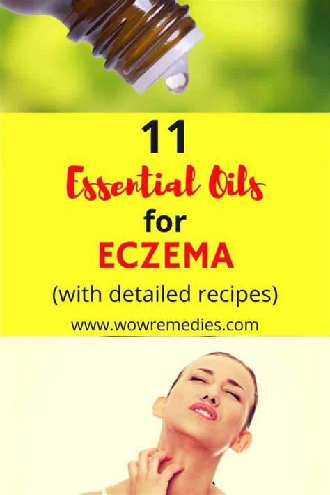 Best Essential Oils For Eczema Eczemaessentialoils Essential Oils