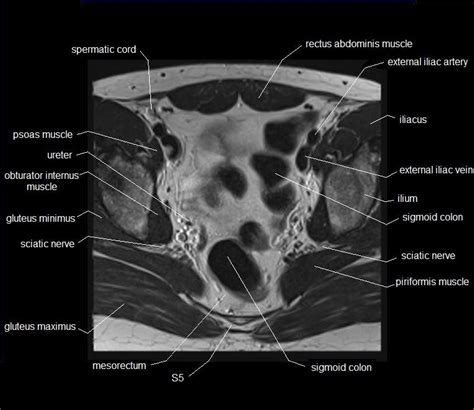 Anatomy lower back muscles diagram, hip anatomy bones, hip anatomy muscles and tendons, hip anatomy muscles ligaments, knee anatomy muscles, lower back muscles names, human muscles related posts of anatomy of muscles hip and lower back. mri hip anatomy - www.unidadortopedia.com PBX: 6923370 ...