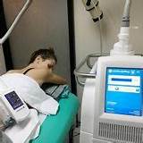 Pictures of Fat Freezing Treatment Prices