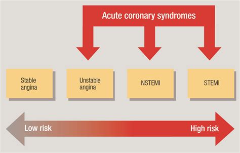 Acute Coronary Syndromes Issues And Answers