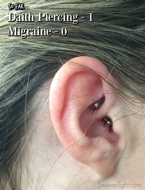 Ear Piercing Chart For Migraines