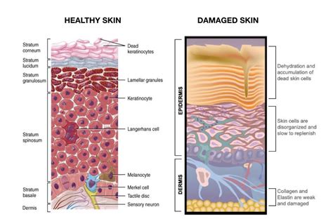 Skin Diagram001 Advanced Skin Courses By Medico Beauty Institute