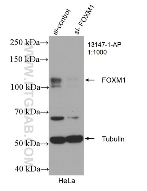 Foxm1 Antibody 13147 1 Ap Proteintech
