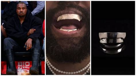 Kanye West Removes All His Teeth Gets Titanium Dentures Worth Rs 707