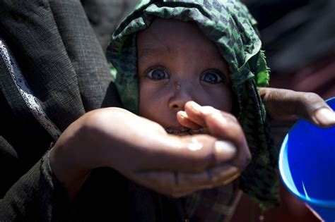 Seca Extrema Na Somália Mundo Não Pode Desviar O Olhar Enquanto Crianças Começam A Morrer