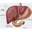 Bile Duct Obstruction Causes And Treatment