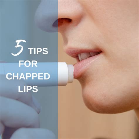 Dry Cracked Lips Try These Tips For Chapped Lips