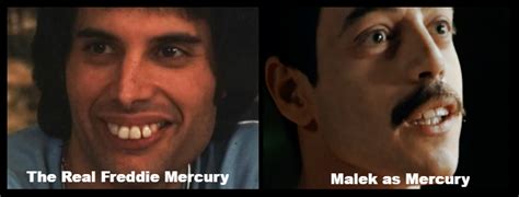 This crowded the rest of his teeth and resulted in his front teeth being pushed forward. Would Invisalign Have Been an Option for Freddie Mercury ...