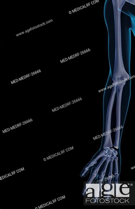 The Bones Of The Upper Limb Stock Photo Picture And Royalty Free