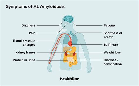 Amyloidosis Symptoms Treatment And More