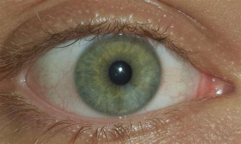 How Would You Describe This Eye Colour Would Sea Green Be Appropriate